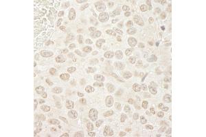 Immunohistochemistry (IHC) image for anti-Protein Phosphatase 3, Catalytic Subunit, alpha Isoform (PPP3CA) (C-Term) antibody (ABIN7448738)