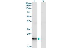 Western Blot analysis of ZMAT4 expression in transfected 293T cell line by ZMAT4 monoclonal antibody (M02), clone 2A4. (ZMAT4 Antikörper  (AA 1-153))