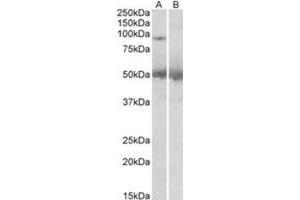 AP31417PU-N USP6 antibody staining of Human Placenta lysate at 2 µg/ml (35 µg protein in RIPA buffer) with (B) and without (A) blocking with the immunizing peptide. (USP6 Antikörper  (C-Term))