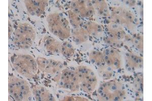 Immunohistochemistry (IHC) image for anti-Procollagen C-Endopeptidase Enhancer 2 (PCOLCE2) (AA 297-415) antibody (ABIN7438220)