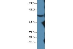 Western blot analysis of Mouse Serum, using Mouse C8b Antibody (2 µg/ml) and HRP-conjugated Goat Anti-Rabbit antibody ( (C8B Antikörper  (AA 161-503))