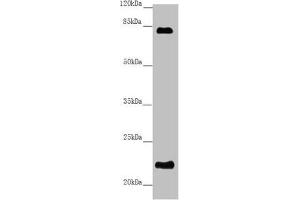 Receptor Accessory Protein 1 Antikörper  (AA 101-201)