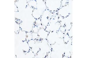 Immunohistochemistry of paraffin-embedded mouse lung using YE Rabbit pAb (ABIN6130808, ABIN6150331, ABIN6150332 and ABIN6221925) at dilution of 1:100 (40x lens). (GAS41 Antikörper  (AA 1-227))
