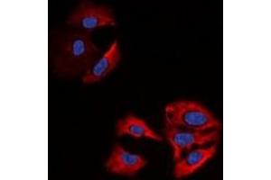 Immunofluorescent analysis of Beta-actin staining in A549 cells. (beta Actin Antikörper)