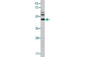 Western blot analysis of MDA-MB-435 cell lysate (35 ug/lane) with MMP16 polyclonal antibody . (MMP16 Antikörper  (N-Term))