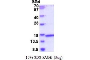 Mitochondrial Ribosomal Protein L2 (MRPL2) (AA 84-202) protein (His tag)
