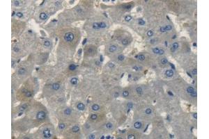 DAB staining on IHC-P; Samples: Human Liver Tissue (NPPC Antikörper  (AA 33-125))