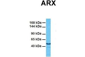 Host:  Rabbit  Target Name:  ARX  Sample Tissue:  Human Fetal Heart  Antibody Dilution:  1. (Arx Antikörper  (Middle Region))