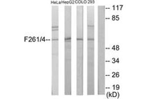 Western blot analysis of extracts from HeLa/HepG2/COLO205/293 cells, using PFKFB1/4 Antibody.