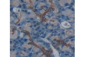 Used in DAB staining on fromalin fixed paraffin- embedded pancreas tissue (Nicastrin Antikörper  (AA 35-534))