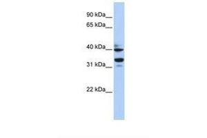 Image no. 1 for anti-Zinc Finger Protein 550 (ZNF550) (AA 84-128) antibody (ABIN6739454) (ZNF550 Antikörper  (AA 84-128))