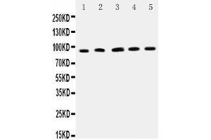Observed bind size: 90KD (ICAM1 Antikörper  (AA 198-537))
