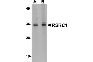 Western Blotting (WB) image for anti-arginine/serine-Rich Coiled-Coil 1 (RSRC1) (C-Term) antibody (ABIN1030630) (RSRC1 Antikörper  (C-Term))