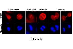 Immunofluorescenitrocellulosee of human HeLa cells stained with Hoechst 3342 (Blue) for chromatin staining and monoclonal anti-human Aurora kinase B antibody (1:2000) with Texas Red (Red).