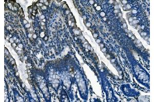 IHC analysis of PI-16/PI16 using anti-PI-16/PI16 antibody (ABIN7601074). (PI16 Antikörper  (AA 28-363))