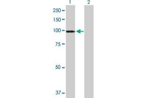 Western Blot analysis of ATP2C1 expression in transfected 293T cell line by ATP2C1 MaxPab polyclonal antibody. (ATP2C1 Antikörper  (AA 1-919))