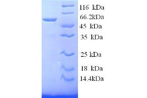 SDS-PAGE (SDS) image for S-Antigen, Retina and Pineal Gland (Arrestin) (SAG) (AA 1-405), (full length) protein (His tag) (ABIN5713812)