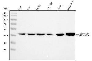 Western blot analysis of SUCLG2 using anti-SUCLG2 antibody (ABIN7601694). (SUCLG2 Antikörper  (AA 42-424))