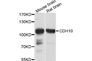 Western blot analysis of extracts of various cell lines, using CDH10 antibody (ABIN4903221) at 1:1000 dilution. (CDH10 Antikörper)