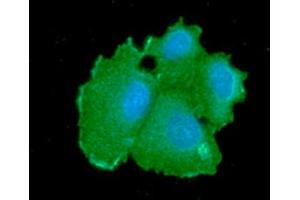 ICC/IF analysis of CBR1 in Hep3B cells line, stained with DAPI (Blue) for nucleus staining and monoclonal anti-CBR1 antibody (1:100) with goat anti-mouse IgG-Alexa fluor 488 conjugate (Green). (CBR1 Antikörper  (AA 1-277))