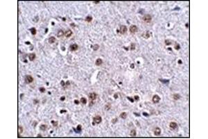 Immunohistochemistry (Paraffin-embedded Sections) (IHC (p)) image for anti-Leucine Rich Repeat and Fibronectin Type III Domain Containing 4 (LRFN4) (C-Term) antibody (ABIN500192)