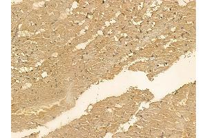 SMAP2 Mouse Monoclonal Antibody at 1/100 staining rat heart tissue by IHC-P. (SMAP2 Antikörper)