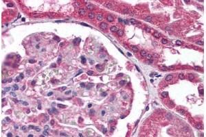 Human Kidney (formalin-fixed, paraffin-embedded) stained with COL18A1 antibody ABIN307188 at 1:100 followed by biotinylated anti-mouse IgG secondary antibody ABIN481714, alkaline phosphatase-streptavidin and chromogen. (COL18A1 Antikörper)