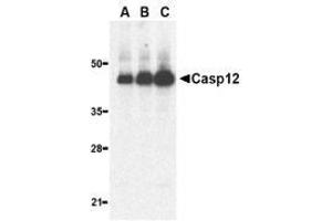 Western blot analysis of caspase-12 in human heart lysate with AP30192PU-N caspase-12 antibody (large) at 0. (Caspase 12 Antikörper  (large))