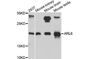 Western blot analysis of extracts of various cell lines, using ARL6 antibody. (ARL6 Antikörper  (AA 1-186))