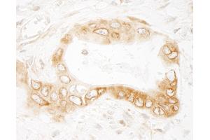 Immunohistochemistry (IHC) image for anti-UV Radiation Resistance Associated Gene (UVRAG) (AA 649-699) antibody (ABIN7453808) (UVRAG Antikörper  (AA 649-699))