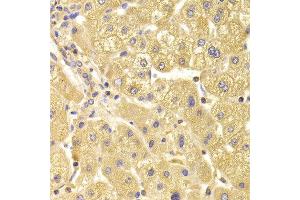 Immunohistochemistry of paraffin-embedded Human liver injury using TRAF3IP2 antibody at dilution of 1:100 (x400 lens).