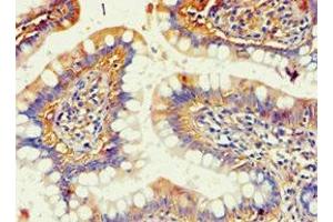 Immunohistochemistry of paraffin-embedded human small intestine tissue using ABIN7143685 at dilution of 1:100 (AKR1B1 Antikörper  (AA 1-316))