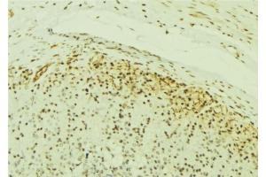 ABIN6277054 at 1/100 staining Human gastric tissue by IHC-P. (IKK alpha Antikörper  (N-Term))