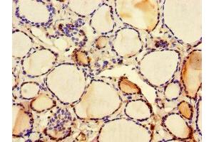 Immunohistochemistry of paraffin-embedded human thyroid tissue using ABIN7146159 at dilution of 1:100 (C2CD3 Antikörper  (AA 2079-2265))