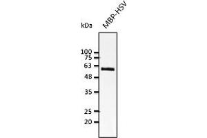 Western Blotting (WB) image for anti-HSV Tag antibody (ABIN7272989) (HSV Tag Antikörper)