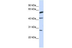 RNF170 antibody used at 1 ug/ml to detect target protein.