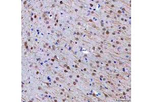 IHC analysis of RTF1 using anti-RTF1 antibody (ABIN7602444). (RTF1 Antikörper  (AA 77-705))