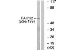 Western blot analysis of extracts from LOVO cells treated with starved 24h, using PAK1 (Phospho-Ser199) Antibody. (PAK1 Antikörper  (pSer199))