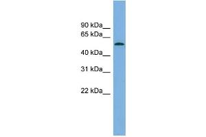 WB Suggested Anti-GLCCI1 Antibody Titration: 0.