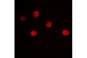 Immunofluorescent analysis of MYF5 staining in Jurkat cells. (MYF5 Antikörper  (Center))