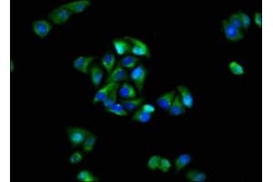 Immunofluorescence staining of Hela cells with ABIN7153969 at 1:100, counter-stained with DAPI. (GRIK1 Antikörper  (AA 675-834))