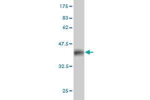 Western Blot detection against Immunogen (36. (PFN2 Antikörper  (AA 41-140))