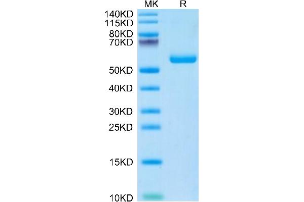 TIMP1 Protein (AA 25-205) (Fc Tag)