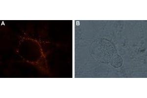 Expression of kainate receptor GluK1 in rat DRG neurons - Cell surface detection of kainate receptor GluK1 in living rat dorsal root ganglion (DRG). (GRIK1 Antikörper  (Extracellular))