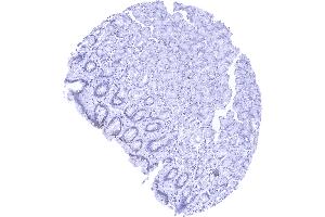 anti-Solute Carrier Family 45, Member 3 (SLC45A3) (N-Term) antibody
