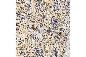 Immunohistochemistry of paraffin embedded mouse spleen using CCRL2 (ABIN7073461) at dilution of 1:300 (400x lens) (CCRL2 Antikörper)