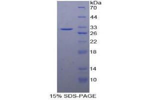 SDS-PAGE (SDS) image for Cadherin 5 (CDH5) (AA 68-307) protein (His tag) (ABIN2124201)