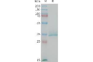 SDS-PAGE (SDS) image for Calcitonin-Related Polypeptide alpha (CALCA) (AA 83-119) protein (Fc Tag) (ABIN7538155)