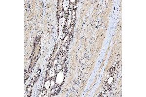 IHC analysis of SNRNP200 using anti-SNRNP200 antibody (ABIN7602032). (SNRNP200 Antikörper  (AA 557-2129))