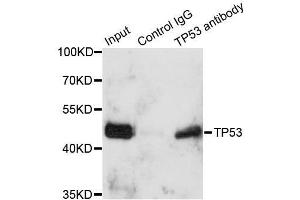 Immunoprecipitation analysis of 150ug extracts of A549 cells using 3ug TP53 antibody. (p53 Antikörper  (AA 1-100))